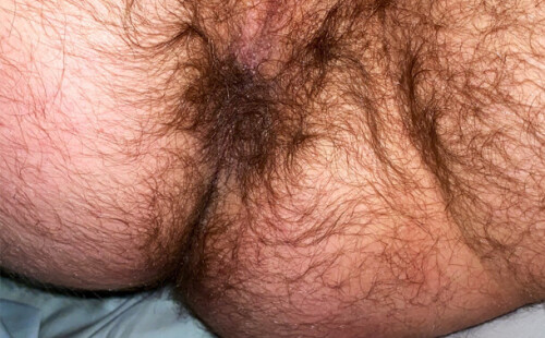 Furrest butt