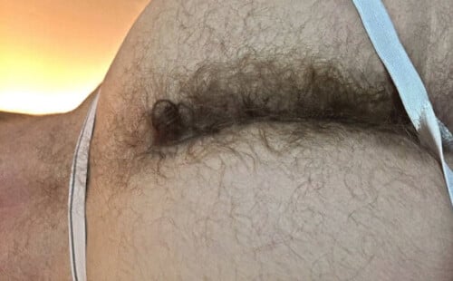 Furry butt