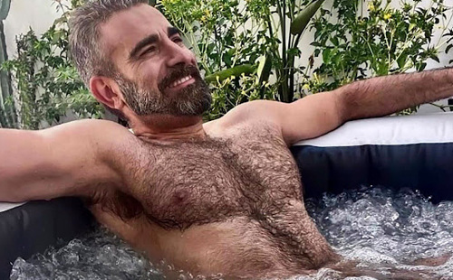 Wet hairy papis